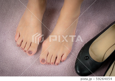 Closeup : Bare feet of woman, she take off her shoes to release pain after long day wearing pointy and narrow shoes  -  Medical condition called bunions (Hallux valgus) Woman's health concept. 59264054