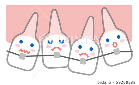 歯並び　歯列矯正　イラスト 59268538