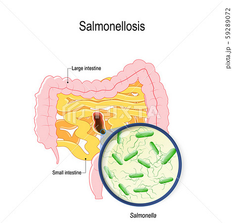 salmonellosis is salmonella poisoning from raw chicken and eggs. human intestines and bacterium that cause this disease 59289072