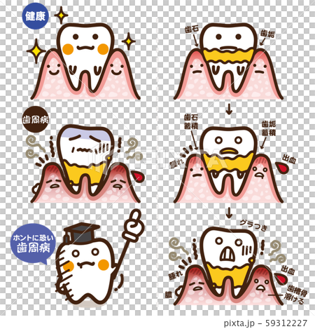 Seikatsu pickup / periodontal disease Seikatsu pickup / periodontal disease 59312227