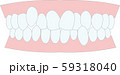 不正咬合　叢生　歯並び 59318040