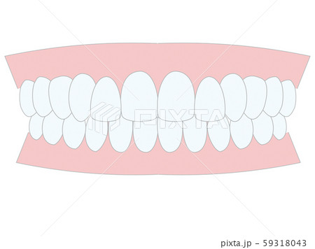きれいな　歯並び 59318043