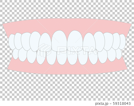 きれいな　歯並び 59318043