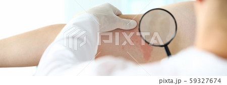 Male doctor in white protective gloves examing patient 59327674