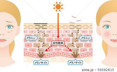 ターンオーバー　肌の断面図と女性 59392615