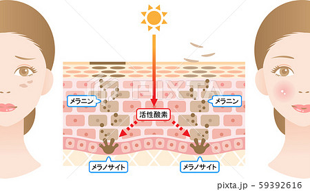 ターンオーバー　肌の断面図と女性 59392616