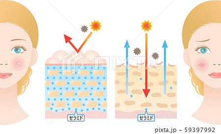 セラミド　健康な肌　乾燥肌  59397992