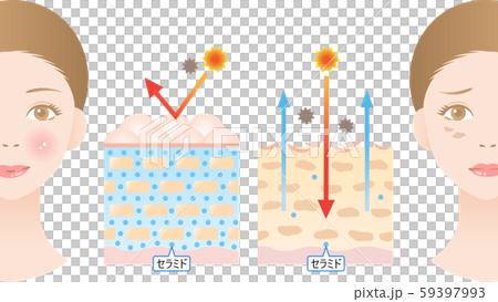 神經酰胺健康的皮膚乾燥的皮膚 59397993