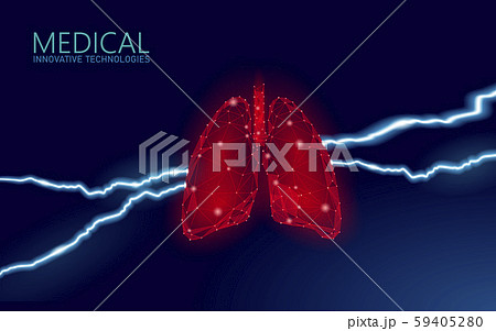 3D human lungs disease prevention medicine concept. Respiratory virus infection cancep danger 3D human lungs disease prevention medicine concept. Respiratory virus infection cancep danger 59405280