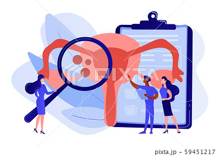 Endometriosis concept vector illustration. 59451217