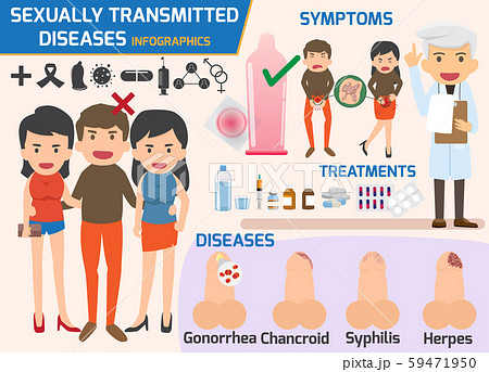 Sexually transmitted diseases infographic, Sexually transmitted diseases infographic, 59471950