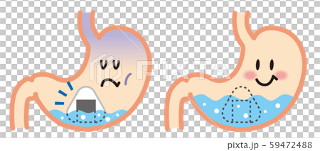 胃　胃散不足　イラスト 59472488