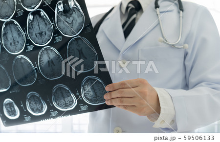 medical brain mri scan 59506133