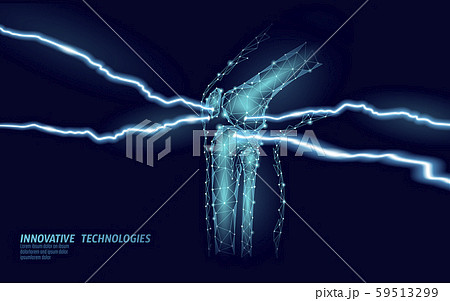 Human knee joint 3d model vector illustration. Low poly design future technology cure pain treatment 59513299