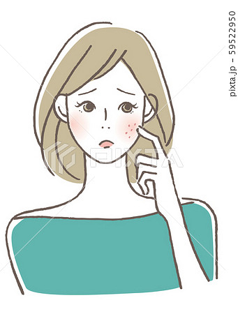 肌のトラブル　ニキビ 59522950