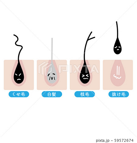 髪の毛のトラブルのイラスト素材 [59572674] - PIXTA