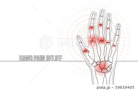 Rheumatoid arthritis continuous line hand bones drawing concept banner 59639405