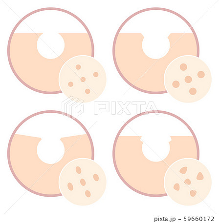 毛穴の種類 毛穴の種類 59660172