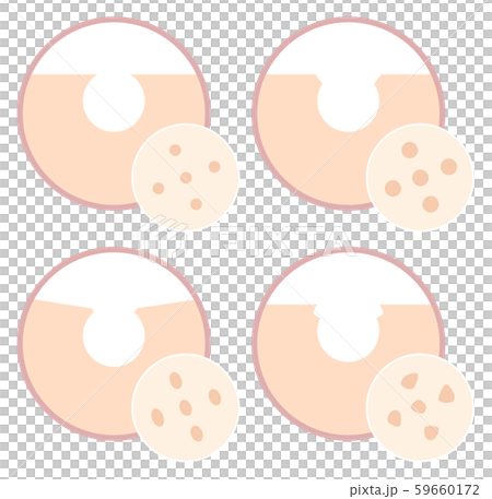 毛穴の種類 毛穴の種類 59660172