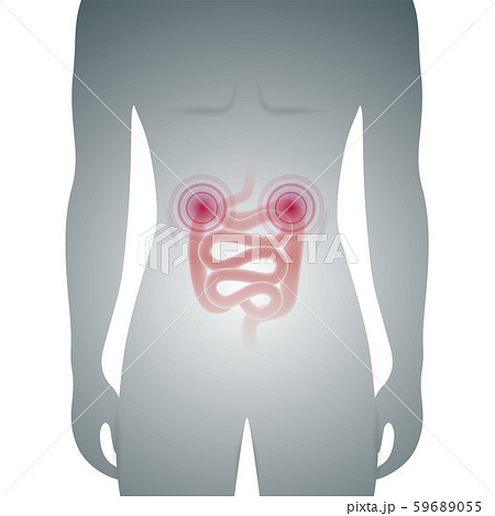 Male silhouette with sick intestine medical vector Male silhouette with sick intestine medical vector 59689055