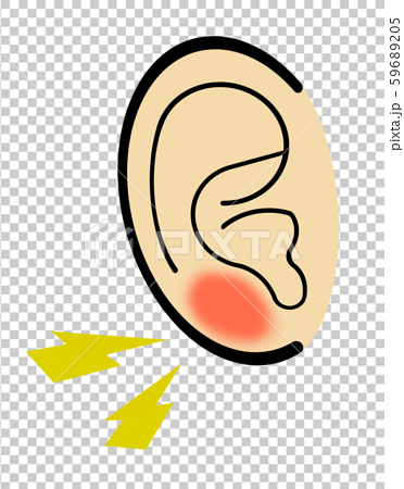 腫れる 耳たぶ 耳たぶがかゆい４つの原因とは！病気の可能性も・・！