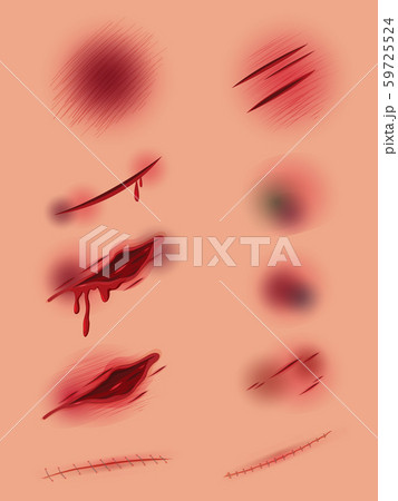 Set of different wound 59725524