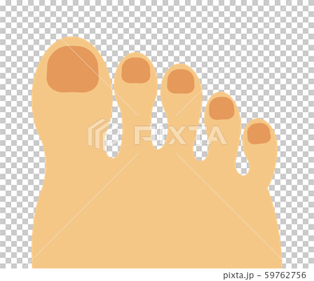 Toe 59762756