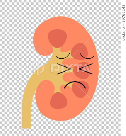 苦しんでいる腎臓 59763142