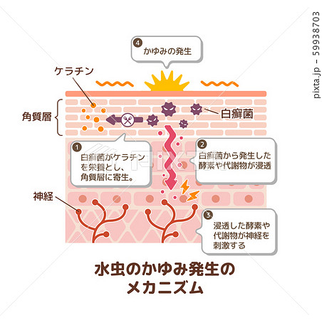 カラー図説白癬 カラー図説白癬 カラー図説白癬 | 福代 良一 |本 | 通販 | Amazon