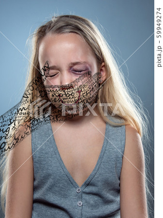 Sad and frightened little girl with bloodshot and bruised eyes, fiction of happiness 59949274