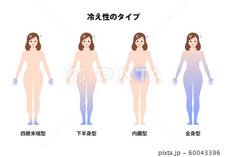 女性の冷え性 体の冷え タイプ別イラストセットのイラスト素材