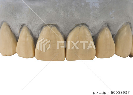 Gypsum model of jaw isolated on white Gypsum model of jaw isolated on white 60058937