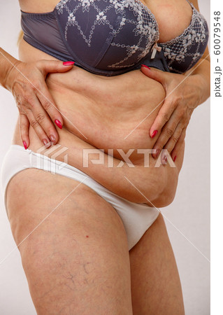 An elderly woman in white panties shows the folds An elderly woman in white panties shows the folds 60079548