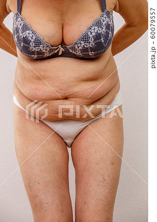 An elderly woman in white panties shows the folds - Stock Photo