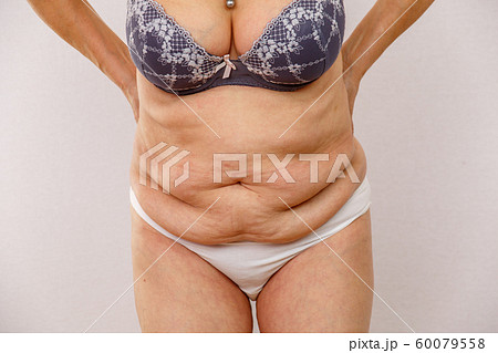 An Elderly Woman In White Panties Shows The Folds On Her Abdomen On A White  Isolated Stock Photo, Picture and Royalty Free Image. Image 128296075.