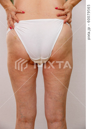 Elderly woman in white panties shows cellulite and 60079565