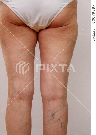 Elderly woman in white panties shows cellulite and Elderly woman in white panties shows cellulite and 60079597