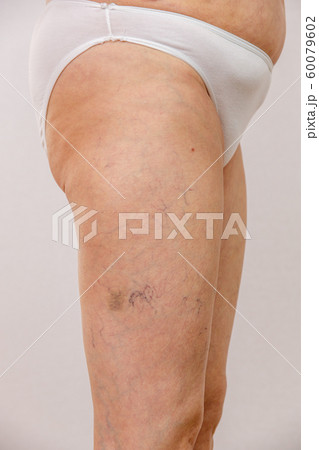 Elderly woman in white panties shows cellulite and 60079602