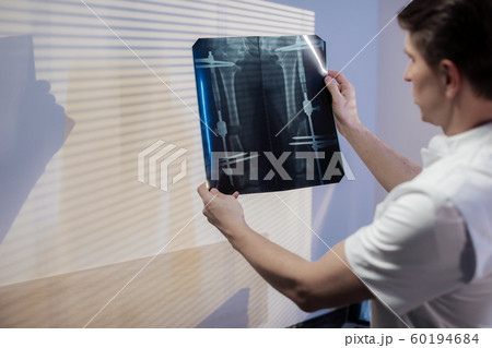 The doctor looks at the patient's x-ray. Work of the clinic doctor 60194684