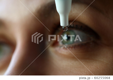 Female putting liquid drops in her eye solving vision problem Female putting liquid drops in her eye solving vision problem 60255068