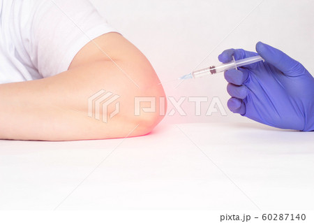 A doctor makes an injection into the elbow joint of a woman who has pain and inflammation in the elbow joint, a concept of modern medicine, plasma therapy injections and hilauric acid, copy space A doctor makes an injection into the elbow joint of a woman who has pain and inflammation in the elbow joint, a concept of modern medicine, plasma therapy injections and hilauric acid, copy space 60287140