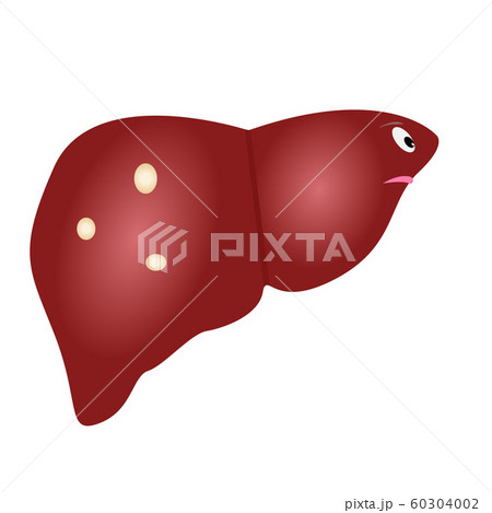 Cute unhealthy liver with cysts icon made in cartoon style. Medical concept. Vector illustration. 60304002
