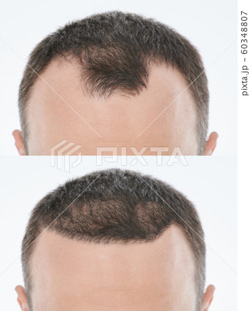 Bold problem treatment 60348807