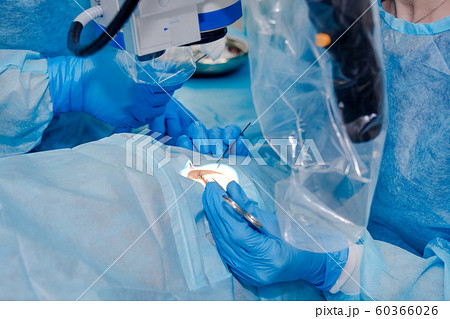Close up of surgery team operating. The operation on the eye. Cataract surgery. Laser vision correction. Patient and team of surgeons in the operating room, patient under sterile cover 60366026