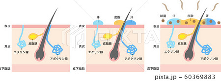 体臭の原因と汗腺　肌の断面図 60369883