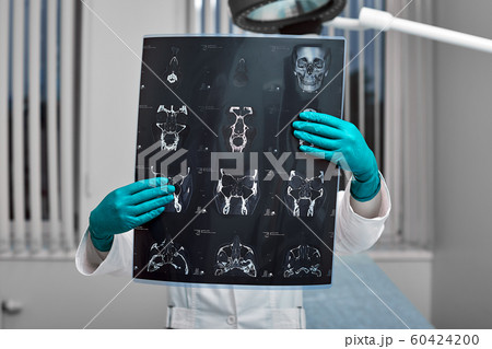 Doctor attentively examines the MRI scan of the patient. Doctor attentively examines the MRI scan of the patient. 60424200