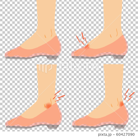 イラスト素材：足 悩み トラブル 痛み パンプス 女性 60427090