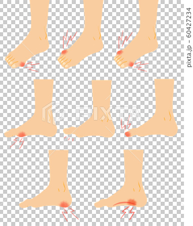 イラスト素材：足 悩み トラブル 痛み 女性 60427234