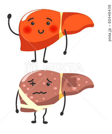 Healthy vs sick liver human organ health comparison 60446436