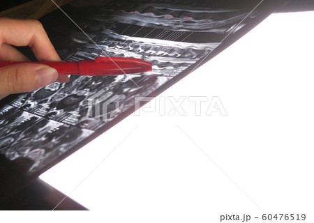 犬の背骨のMRI 犬の背骨のMRI 60476519